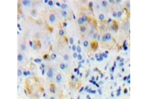 IHC-P analysis of Liver tissue, with DAB staining. (Oncostatin M Receptor anticorps  (AA 503-749))