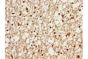 IHC image of ABIN7160445 diluted at 1:600 and staining in paraffin-embedded human brain tissue performed on a Leica BondTM system.