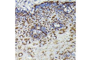 Immunohistochemistry of paraffin-embedded human esophageal using SOD2 antibody (ABIN7270638) at dilution of 1:100 (40x lens).