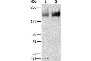 Western blot analysis of Human jejunoileum and ileum tissue, using TRPM6 Polyclonal Antibody at dilution of 1:200 (TRPM6 anticorps)