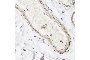 Immunohistochemistry of paraffin-embedded human colon using CAV3 antibody (ABIN5974782) at dilution of 1/200 (40x lens). (Caveolin 3 anticorps)
