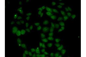 Immunofluorescence analysis of U2OS cells using FGF14 antibody. (FGF14 anticorps  (AA 1-252))