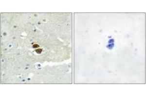 Immunohistochemistry analysis of paraffin-embedded human brain, using n-NOS (Phospho-Ser852) Antibody. (NOS1 anticorps  (pSer852))