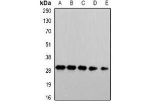 Western blot analysis of PSMA4 expression in HepG2 (A), Jurkat (B), mouse liver (C), COS7 (D), PC12 (E) whole cell lysates. (PSMA4 anticorps)