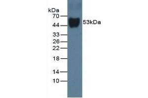 Western Blot; Sample: Rat Serum. (Vitamin D-Binding Protein anticorps  (AA 209-394))