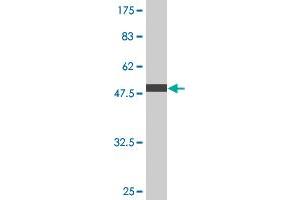Western Blot detection against Immunogen (50. (SSX2 anticorps  (AA 1-223))