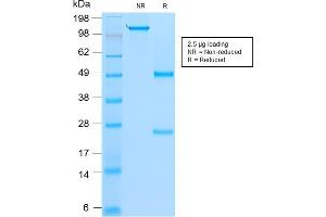 SDS-PAGE Analysis Purified MyoD1 Mouse Recombinant Monoclonal Antibody (rMYD712).