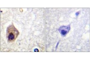 Immunohistochemistry analysis of paraffin-embedded human brain tissue, using Caspase 1 (Ab-376) Antibody. (Caspase 1 anticorps  (AA 342-391))