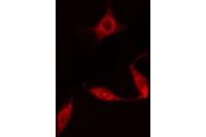 ABIN6278006 staining  HuvEc cells by IF/ICC. (DAPK3 anticorps  (Internal Region))