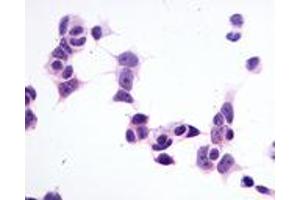 Anti-GPR1 antibody immunocytochemistry (ICC) staining of untransfected HEK293 human embryonic kidney cells.