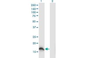 Western Blot analysis of SOD1 expression in transfected 293T cell line by SOD1 monoclonal antibody (M04), clone 10D5. (SOD1 anticorps  (AA 1-154))