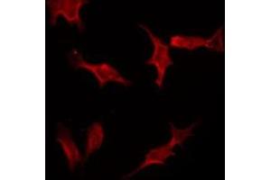 ABIN6266520 staining HeLa by IF/ICC.