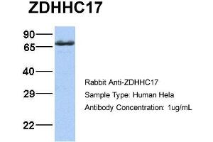Host:  Rabbit  Target Name:  ZDHHC17  Sample Type:  Hela  Antibody Dilution:  1. (ZDHHC17 anticorps  (Middle Region))