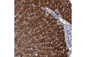 Immunohistochemical staining of human liver with SLC22A25 polyclonal antibody  shows strong cytoplasmic positivity in hepatocytes at 1:50-1:200 dilution.