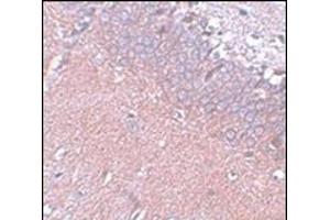 Immunohistochemistry of SYNGR4 in rat brain tissue with this product at 5 μg/ml (SYNGR4 anticorps  (N-Term))