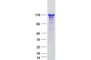 Validation with Western Blot