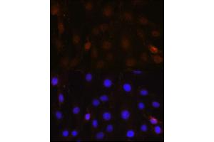 Immunofluorescence analysis of C6 cells using NRBF2 Rabbit pAb  at dilution of 1:100 (40x lens). (NRBF2 anticorps  (AA 10-220))