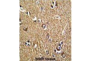 Immunohistochemistry (IHC) image for anti-Fragile X Mental Retardation 1 (FMR1) antibody (ABIN3002852)