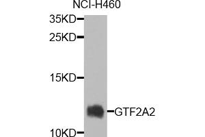 Western blot analysis of extracts of NCI-H460 cells, using GTF2A2 antibody (ABIN5974759) at 1/1000 dilution. (GTF2A2 anticorps)