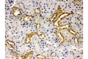 IHC-P: Presenilin 2 antibody testing of rat kidney tissue (Presenilin 2 anticorps  (N-Term))