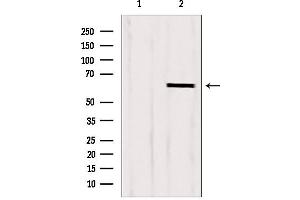 Western blot analysis of extracts from HepG2, using CKAP4 antibody.