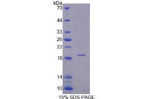 SDS-PAGE analysis of Human INPP4A Protein. (INPP4A Protéine)