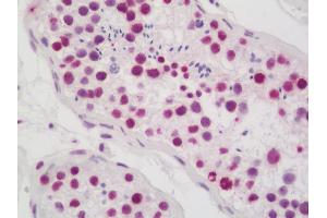 Anti-CASP1 / Caspase 1 antibody IHC staining of human testis. (Caspase 1 anticorps  (AA 120-269) (FITC))