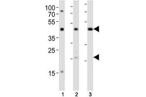 Western blot analysis of lysate from (1) K562, (2) L929 cell line and (3) rat lung tissue using TGFB1 antibody diluted at 1:1000.