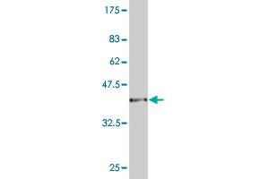 Western Blot detection against Immunogen (37. (CAMK2D anticorps  (AA 301-410))