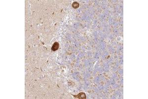 Immunohistochemical staining of human cerebellum with LRRC15 polyclonal antibody  shows strong cytoplasmic positivity in Purkinje cells at 1:20-1:50 dilution. (LRRC15 anticorps)