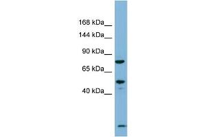 Host:  Rabbit  Target Name:  PDZRN3  Sample Type:  Fetal Thymus lysates  Antibody Dilution:  1. (PDZRN3 anticorps  (N-Term))