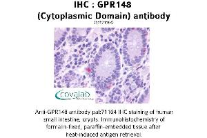 Image no. 1 for anti-G Protein-Coupled Receptor 148 (GPR148) (3rd Cytoplasmic Domain) antibody (ABIN1734951)