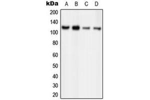 Western blot analysis of ORC1 expression in HeLa (A), MCF7 (B), PC12 (C), Ramos (D) whole cell lysates. (ORC1 anticorps  (Center))
