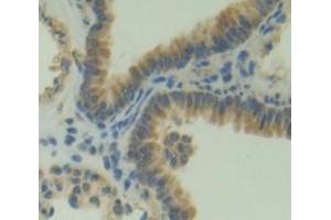Used in DAB staining on fromalin fixed paraffin- embedded Kidney tissue
