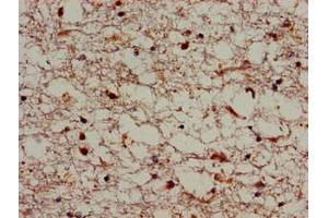 Immunohistochemistry of paraffin-embedded human brain tissue using ABIN7170339 at dilution of 1:100