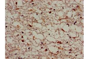 Immunohistochemistry of paraffin-embedded human brain tissue using ABIN7170339 at dilution of 1:100 (SORL1 anticorps  (AA 525-744))