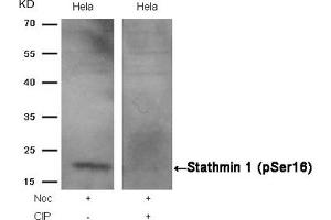 Western blot analysis of extracts from Hela cells, treated with Noc or calf intestinal phosphatase (CIP), using Stathmin 1 (Phospho-Ser16) Antibody.