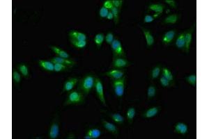 Immunofluorescent analysis of Hela cells using ABIN7153422 at dilution of 1:100 and Alexa Fluor 488-congugated AffiniPure Goat Anti-Rabbit IgG(H+L) (GALT anticorps  (AA 1-379))