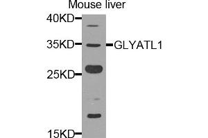 Western blot analysis of extracts of mouse liver, using GLYATL1 antibody. (GLYATL1 anticorps)