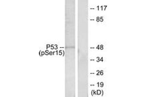 Western blot analysis of extracts from HeLa cells treated with HU, using p53 (Phospho-Ser15) Antibody. (p53 anticorps  (pSer15))