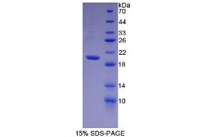 SDS-PAGE (SDS) image for Heparanase (HPSE) (AA 400-543) protein (His tag) (ABIN1170620) (HPSE Protein (AA 400-543) (His tag))