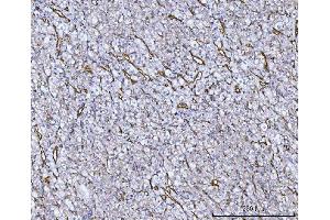 IHC analysis of Von Willebrand Factor/VWF using anti-Von Willebrand Factor/VWF antibody (ABIN7599909).