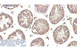Immunohistochemistry of paraffin-embedded Mouse testis tissue using EFHD1 Monoclonal Antibody at dilution of 1:200.