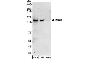 Western Blotting (WB) image for anti-Solute Carrier Family 12 (Potassium-Chloride Transporter) Member 6 (SLC12A6) (AA 25-75) antibody (ABIN7453113)