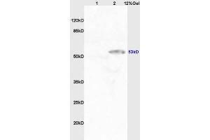 Lane 1: mouse kidney lysates Lane 2: human kidney lysates probed with Anti CYP11A1/P450SCC Polyclonal Antibody, Unconjugated (ABIN701530) at 1:200 in 4 °C.
