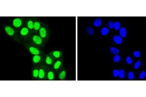 HepG2 cells were stained with HDAC8 (4C3) Monoclonal Antibody  at [1:200] incubated overnight at 4C, followed by secondary antibody incubation, DAPI staining of the nuclei and detection. (HDAC8 anticorps)