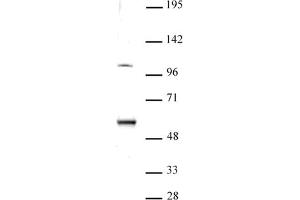 ELP3 antibody (pAb) tested by Western blot. (ELP3/KAT9 anticorps  (N-Term))