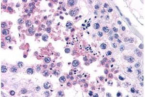 Human Testis (formalin-fixed, paraffin-embedded) stained with CAMP antibody ABIN343893 at 5 ug/ml followed by biotinylated goat anti-rabbit IgG secondary antibody ABIN481713, alkaline phosphatase-streptavidin and chromogen.