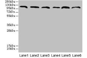 Western blot All lanes: CATSPERE antibody at 6 μg/mL Lane 1: U87 whole cell lysate Lane 2: HepG2 whole cell lysate Lane 3: A549 whole cell lysate Lane 4: Mouse lung tissue Lane 5: Mouse liver tissue Lane 6: PC-3 whole cell lysate Secondary Goat polyclonal to rabbit IgG at 1/10000 dilution Predicted band size: 110, 96, 93 kDa Observed band size: 110 kDa (Cation Channel Sperm-Associated Protein Subunit epsilon (CATSPERE) (AA 601-832) anticorps)