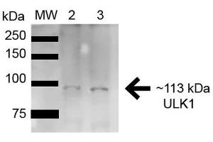 Western blot analysis of Rat Brain cell lysates showing detection of ~112. (ULK1 anticorps  (AA 567-577) (APC))